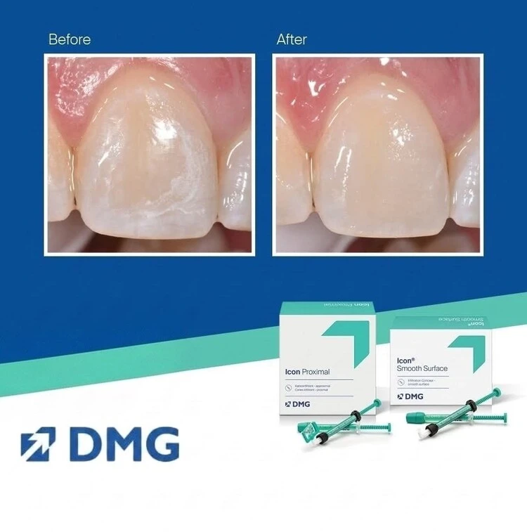Icon-White-Spot-Treatment